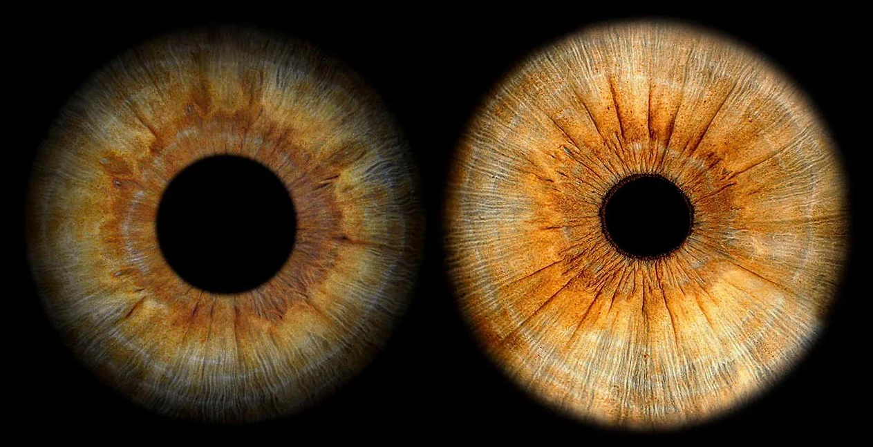 Vergleich Irisfotografie Qualität